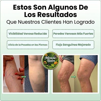 RENUVIA Bálsamo para Várices