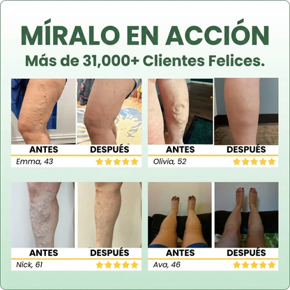 RENUVIA Bálsamo para Várices